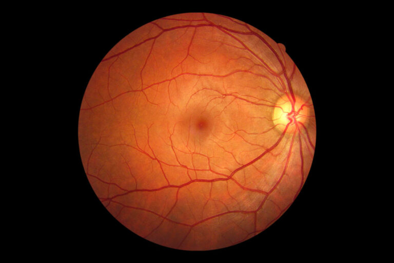25046-retinal-imaging